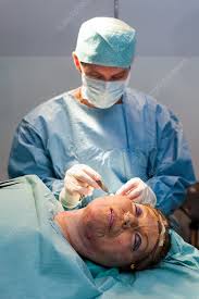This image is about the best facial plastic surgery in North Kolkata