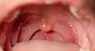 This image is about the best oral cancer clinic in Sodepur 
