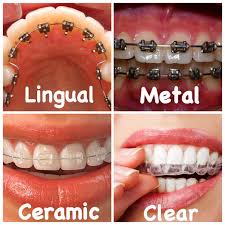 This image is about the orthodontic treatment for teenagers in Kolkata